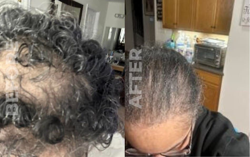  Mane Attraction Hair Growth Oil before and after