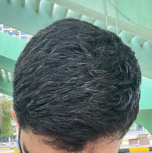 How to Avoid the Gray Hair?